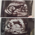 Leonard Kenny & Leo James Boyd